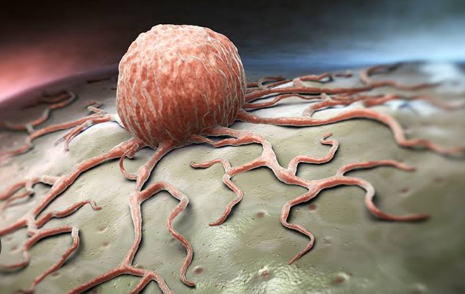 Türkiye’nin Kanser Haritası Açıklandı: Siirt Kanser Ölüm Oranı En Düşük İl